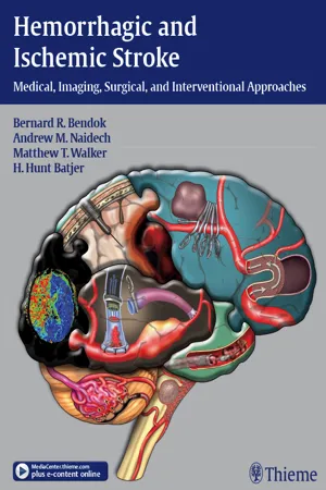 Hemorrhagic and Ischemic Stroke