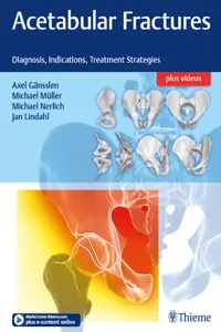 Acetabular Fractures_cover