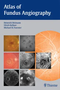 Atlas of Fundus Angiography_cover