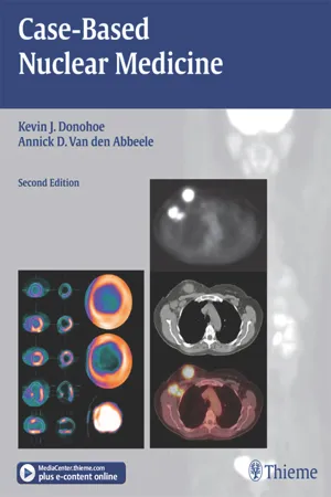 Case-Based Nuclear Medicine