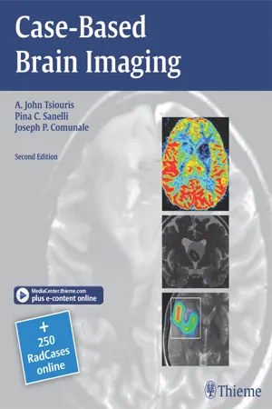 Case-Based Brain Imaging