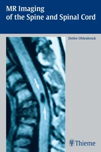 MR Imaging of the Spine and Spinal Cord_cover