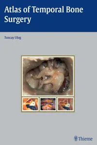 Atlas of Temporal Bone Surgery_cover