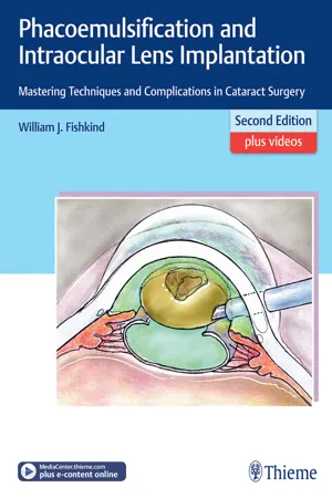 Phacoemulsification and Intraocular Lens Implantation