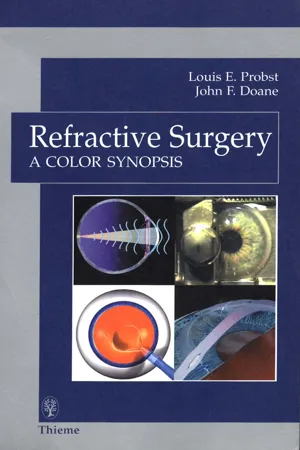 Refractive Surgery