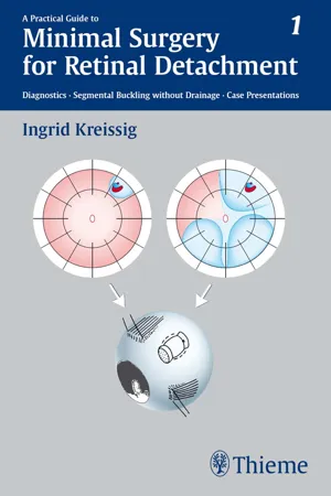 A Practical Guide to Minimal Surgery for Retinal Detachment, Vol. 1