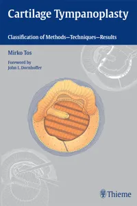 Cartilage Tympanoplasty_cover