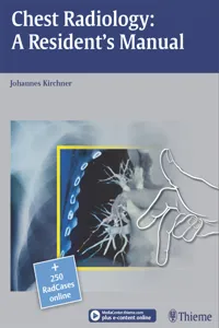 Chest Radiology: A Resident's Manual_cover