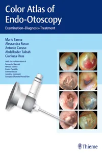 Color Atlas of Endo-Otoscopy_cover