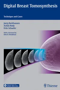 Digital Breast Tomosynthesis_cover