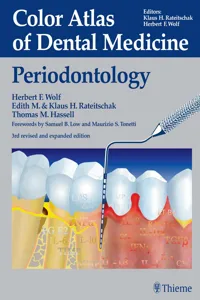 Color Atlas of Dental Medicine: Periodontology_cover