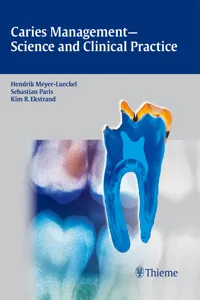 Caries Management - Science and Clinical Practice_cover