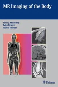MR Imaging of the Body_cover