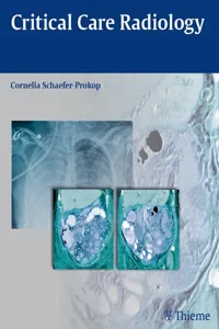 Critical Care Radiology_cover