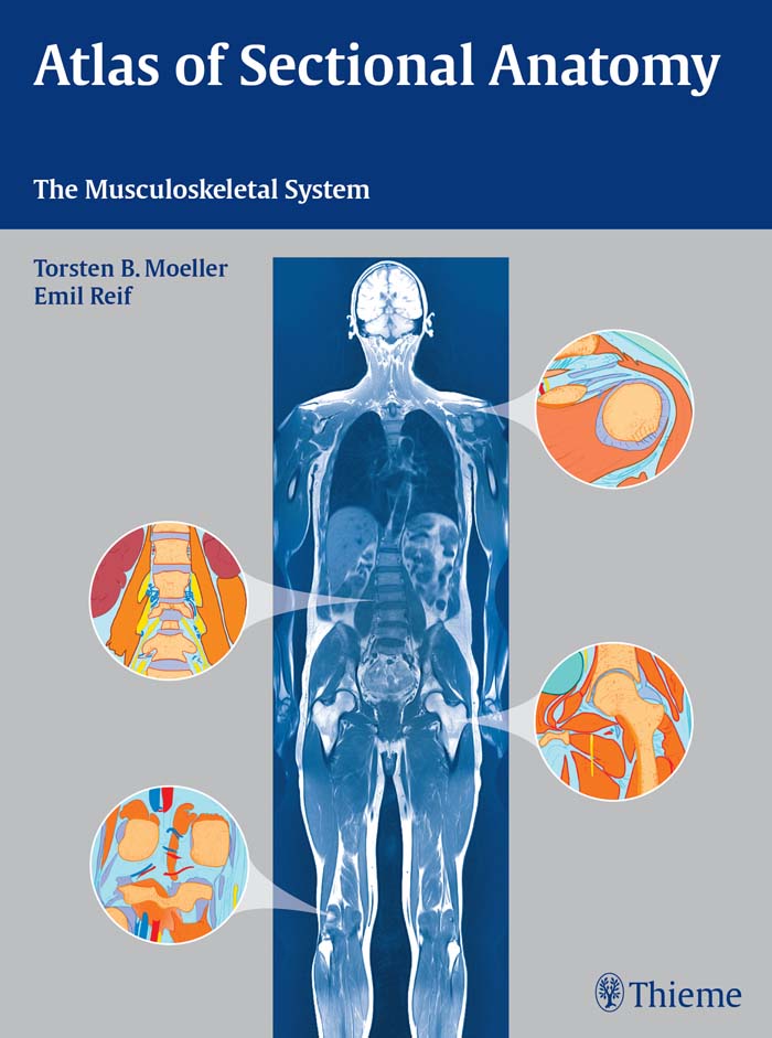 PDF] Atlas of Sectional Anatomy by Torsten Bert Möller | 9783131470614