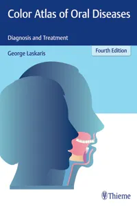 Color Atlas of Oral Diseases_cover