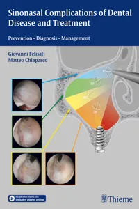 Sinonasal Complications of Dental Disease and Treatment_cover