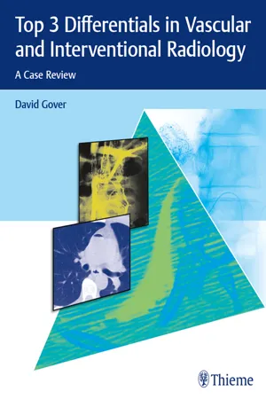 Top 3 Differentials in Vascular and Interventional Radiology