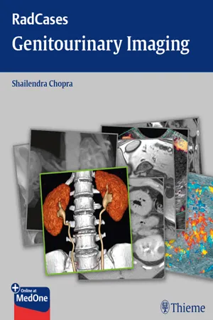 Radcases Genitourinary Imaging