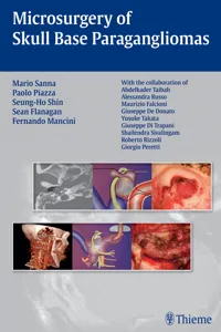 Microsurgery of Skull Base Paragangliomas_cover