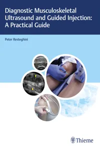 Diagnostic Musculoskeletal Ultrasound and Guided Injection: A Practical Guide_cover