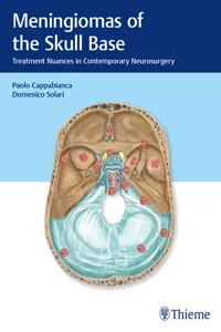 Meningiomas of the Skull Base_cover