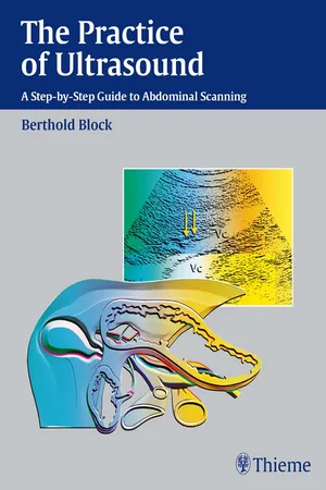 Practice of Ultrasound: A Step-by-Step Guide to Abdominal Scanning