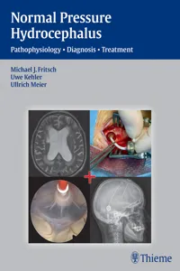 Normal Pressure Hydrocephalus_cover