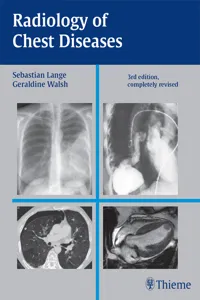 Radiology of Chest Diseases_cover