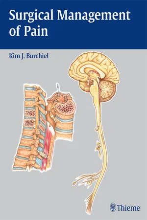 Surgical Management of Pain