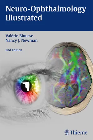 Neuro-Ophthalmology Illustrated