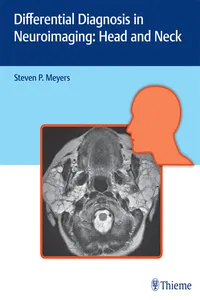 Differential Diagnosis in Neuroimaging: Head and Neck_cover