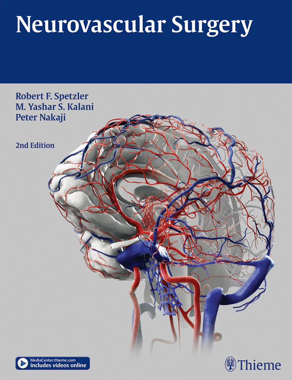 PDF] Neurovascular Surgery by Robert F. Spetzler, 2nd edition