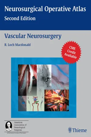 Vascular Neurosurgery