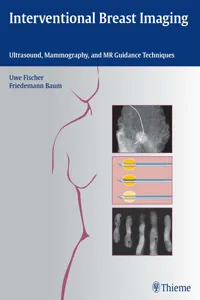 Interventional Breast Imaging_cover