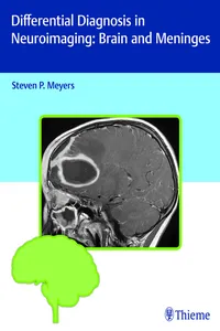 Differential Diagnosis in Neuroimaging: Brain and Meninges_cover