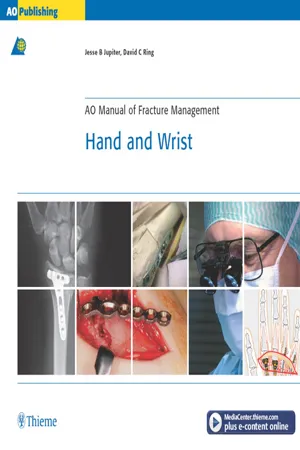 AO Manual of Fracture Management - Hand and Wrist