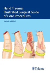 Hand Trauma: Illustrated Surgical Guide of Core Procedures_cover