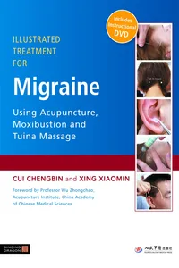 Illustrated Treatment for Migraine Using Acupuncture, Moxibustion and Tuina Massage_cover