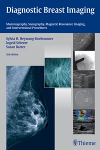 Diagnostic Breast Imaging_cover