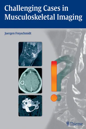 Challenging Cases in Musculoskeletal Imaging