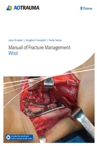 Manual of Fracture Management - Wrist_cover