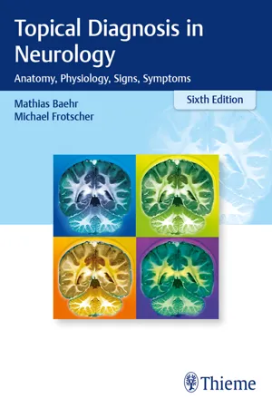 Topical Diagnosis in Neurology