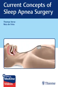 Current Concepts of Sleep Apnea Surgery_cover