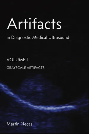 Artifacts in Diagnostic Medical Ultrasound