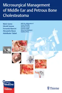 Microsurgical Management of Middle Ear and Petrous Bone Cholesteatoma_cover