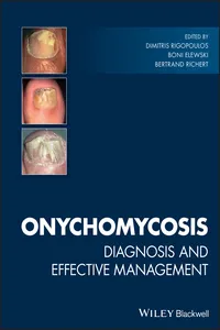 Onychomycosis_cover