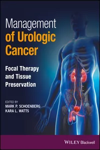 Management of Urologic Cancer_cover