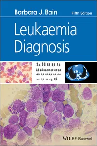 Leukaemia Diagnosis_cover