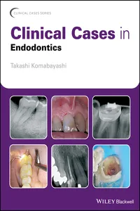Clinical Cases in Endodontics_cover